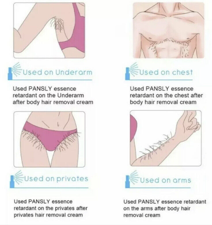 Permanent Spray Haarentfernung - Beine Brust Gesicht Bauch Achseln (NEU)