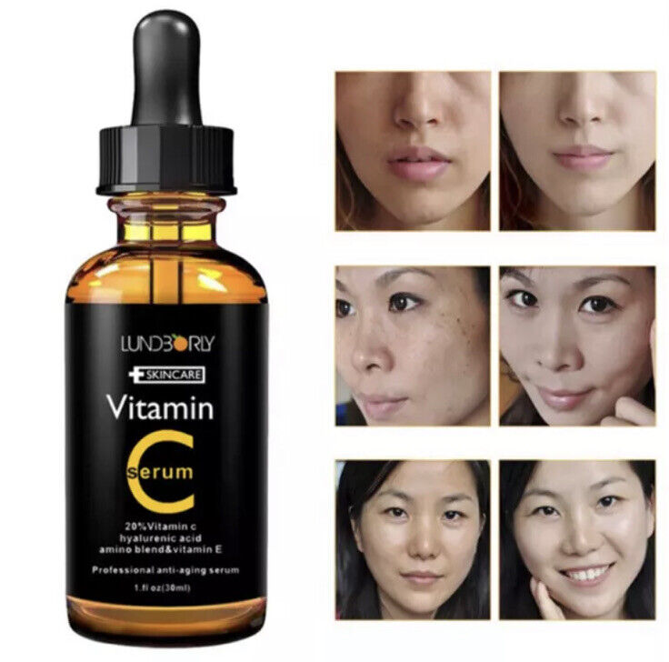 30 ml Vitamin C Serum 20%, Retinol Serum Straffend Anti-Aging, Akne Behandlung